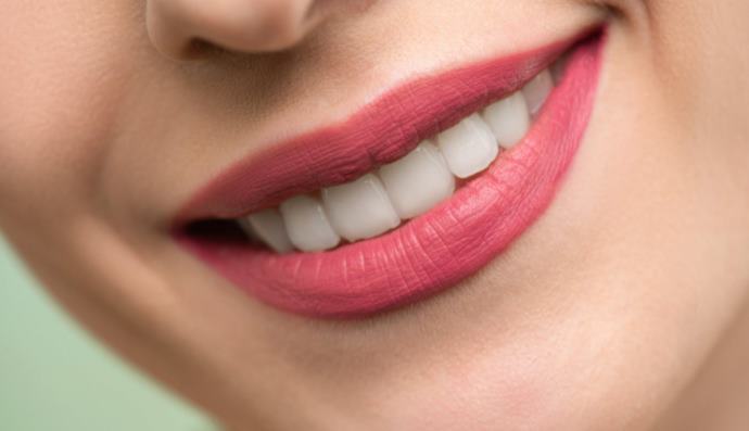 What is Professional Teeth Whitening?
